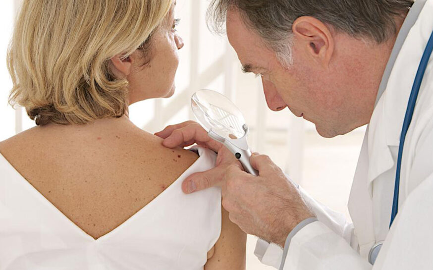 4 common treatment options for myeloma-affected patients