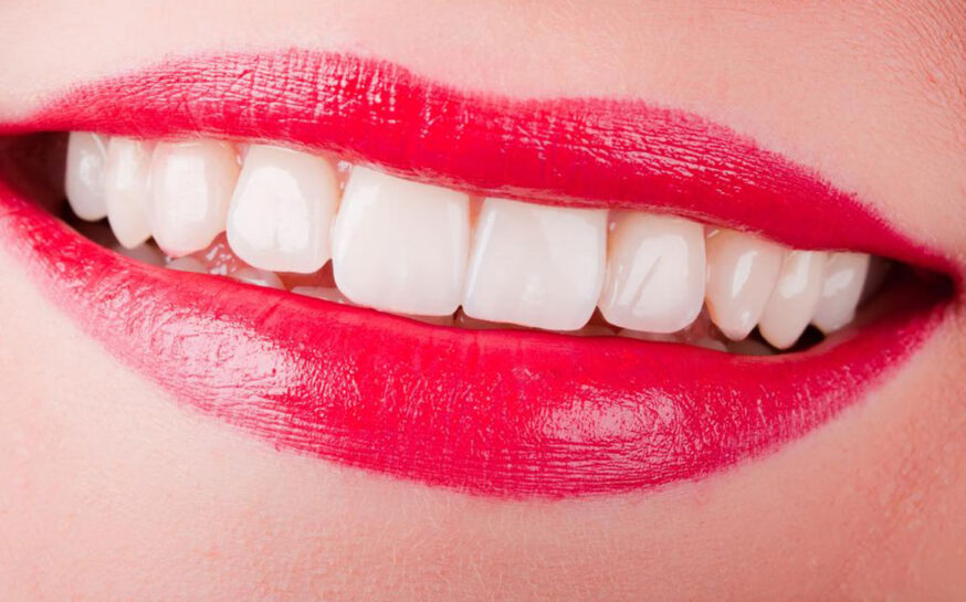 4 useful tips for sparkling pearly white teeth