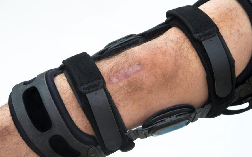 Different types of Mueller knee braces to choose from