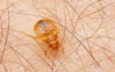 How to figure out if your home is infested bed bugs