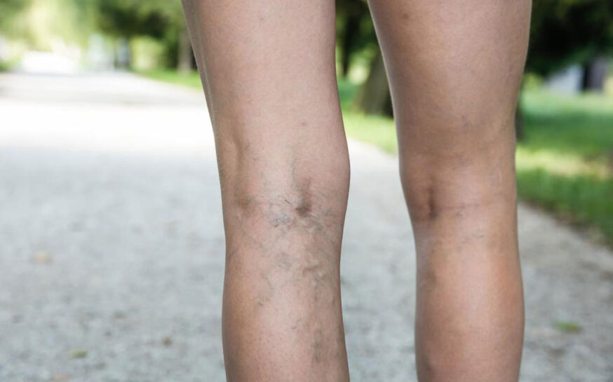 Tips to choose the right circulation socks for you