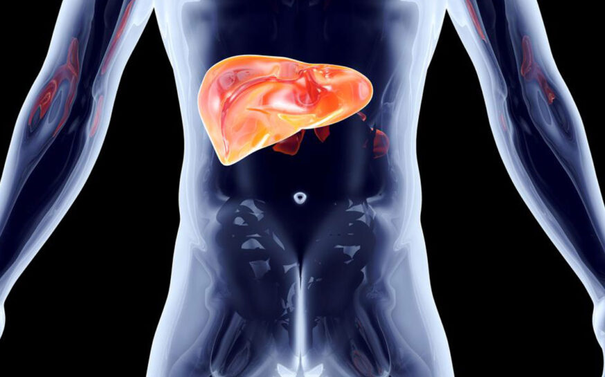What does stage 4 Hepatitis C mean for your liver